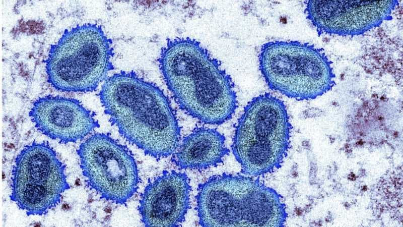 Monkeypox: Afrika Dışındaki Vakalar Üç Haftada 780'e Yükseldi