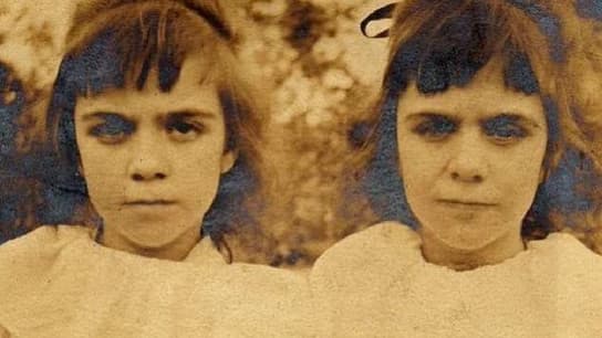 Okuduktan Sonra Reenkarnasyonu Sorgulamamanın İmkansız Olacağı Esrarengiz Olay: Pollock İkizleri